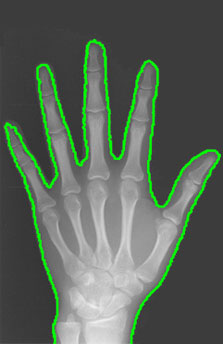 Dataset Image